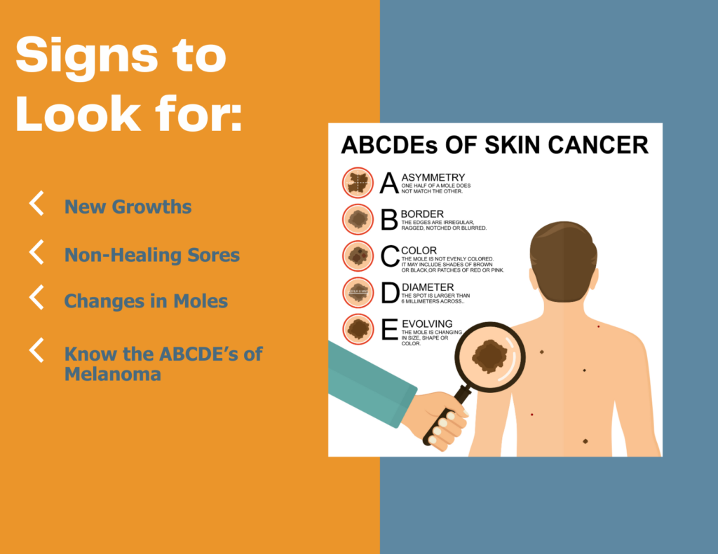 skin cancer