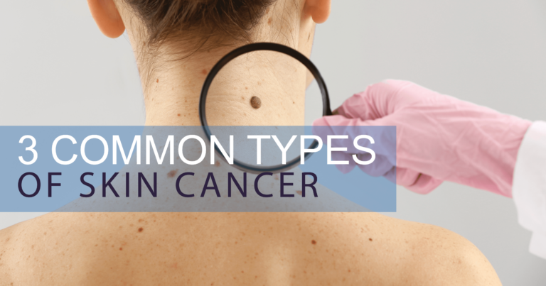 Skin Cancer